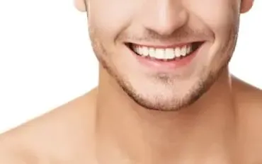 Descubre los tipos de tratamientos de diseño de sonrisa